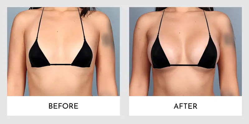 Before & After Photo