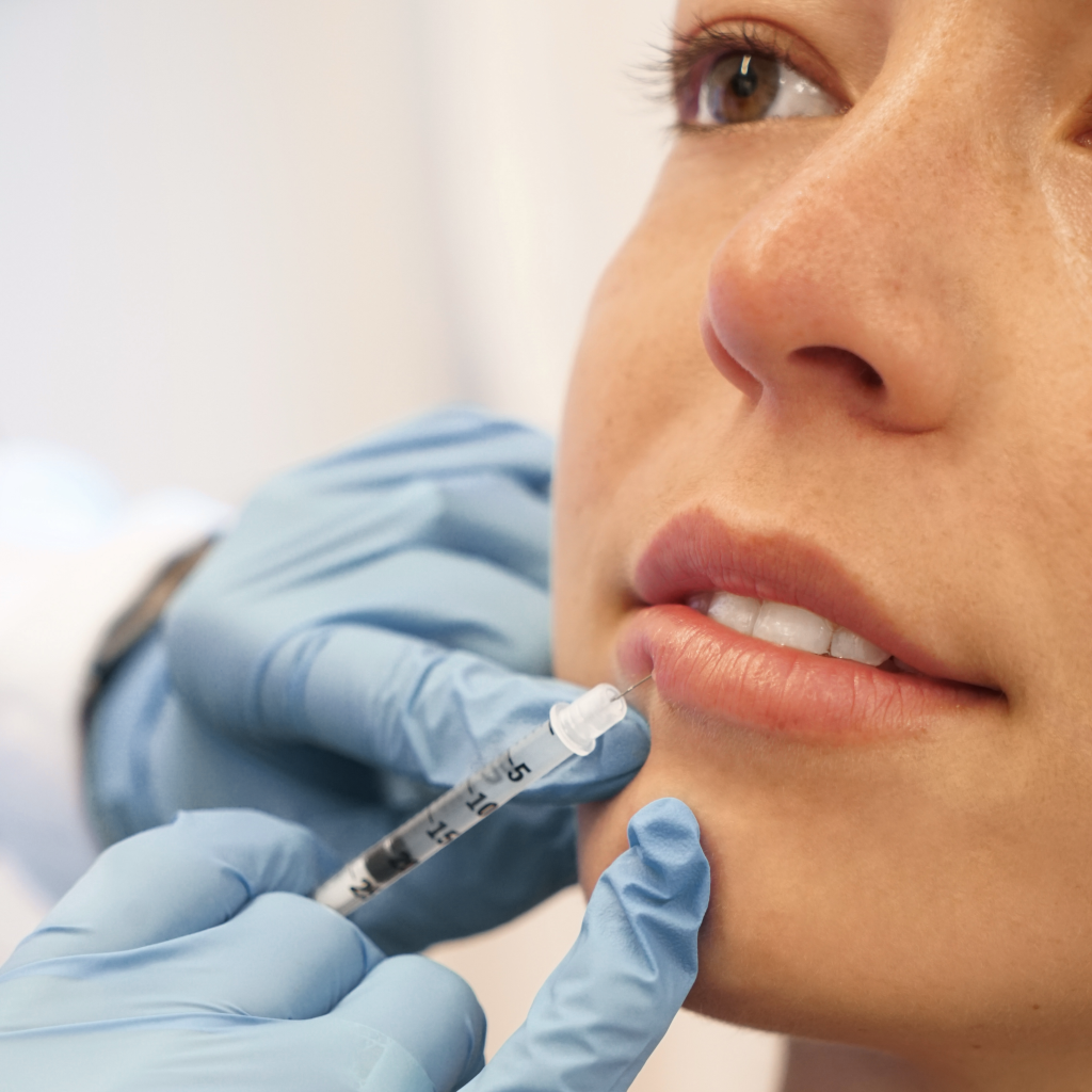 PM Skincare - A detailed view of a cosmetic injection enhancing lip appearance.