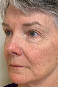 - Plastic Surgery in Marina Del Rey, CA