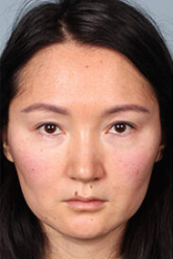 - Plastic Surgery in Marina Del Rey, CA