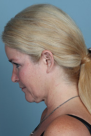 fl1