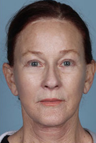 fl4