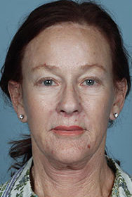 fl4