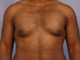 gyne7