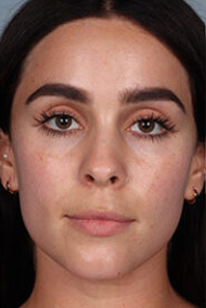 - Plastic Surgery in Marina Del Rey, CA