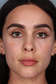 - Plastic Surgery in Marina Del Rey, CA