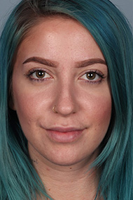 - Plastic Surgery in Marina Del Rey, CA