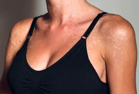 - Plastic Surgery in Marina Del Rey, CA