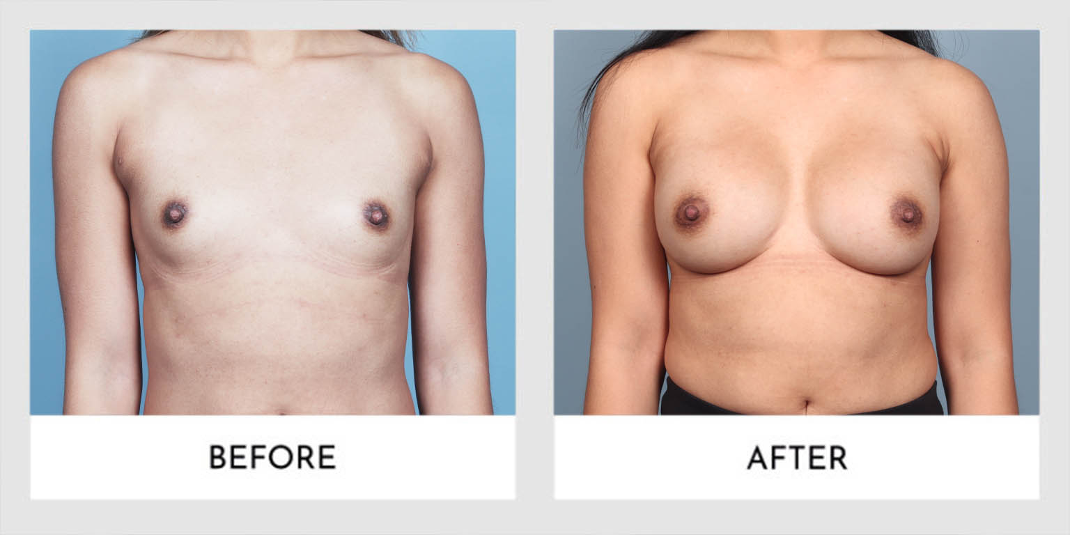 1_0003_01-15-768×384