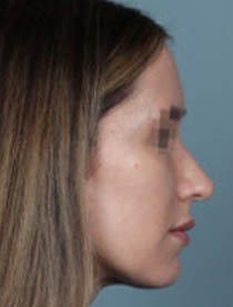 1_0001_rp-p01-1-768×384.jpg