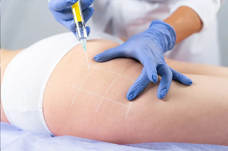 article-fat-injection